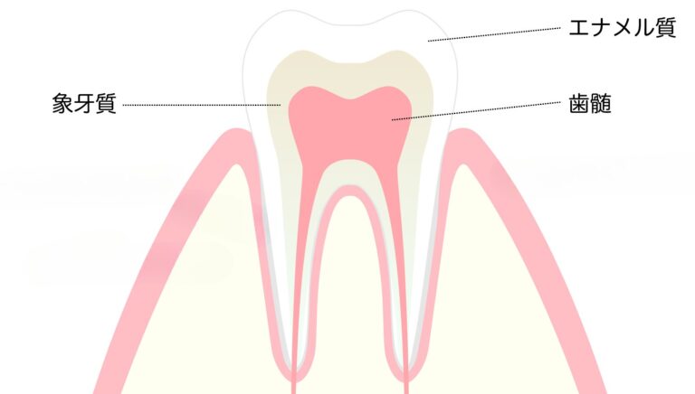 放っておくと怖いむし歯の進行と、痛みのメカニズム・早期発見のすすめ|伊丹とく歯科|伊丹市で“丁寧すぎる”歯科治療。精密な技術と審美の追求